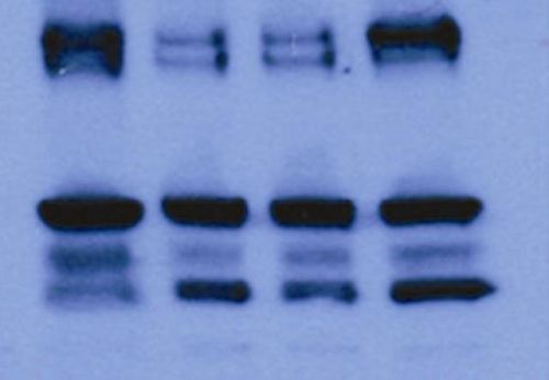 Cellulose nitrate transfer membrane without reinforcement