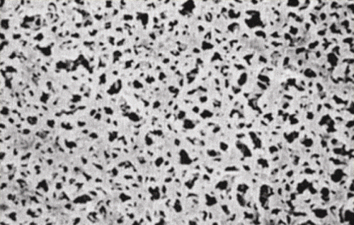 Cellulóz acetát membránszűrő, fehér