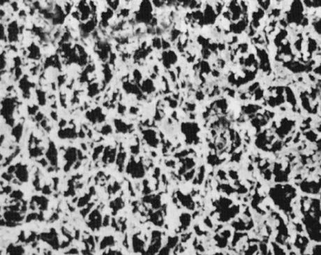 Nylon fecskendőszűrő, hidrofil