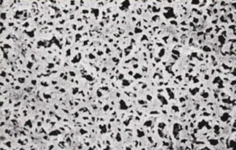 Cellulose acetate membrane filter, white