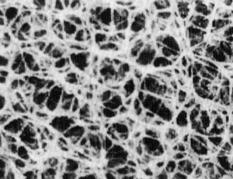 Regenerált cellulóz fecskendőszűrő